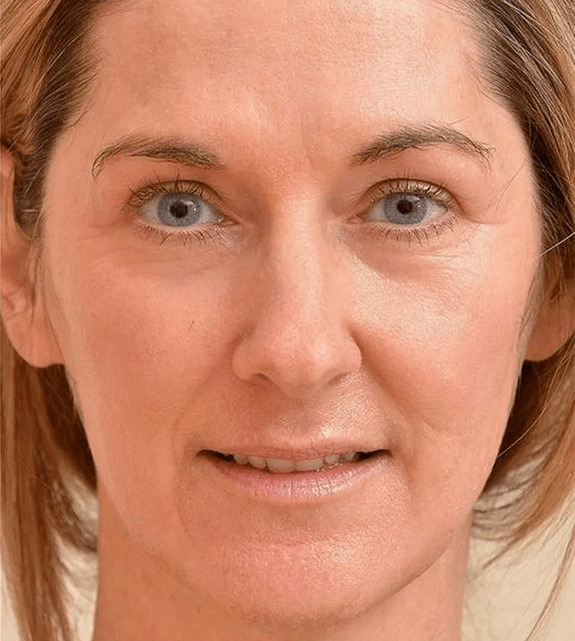 Ich sehe jünger aus, nachdem ich Eudalie -Creme aufgetragen habe